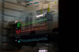 6.424 νέα κρούσματα και 77 θάνατοι – Στους 661 οι διασωληνωμένοι
