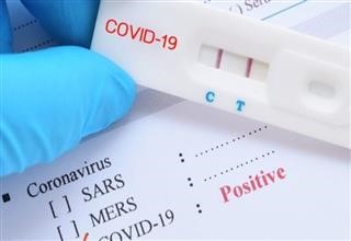 Κρούσματα κορονοϊού στον ΑΟ Υπάτου