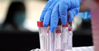 Η επιδημιολογική εικόνα σε όλη τη χώρα