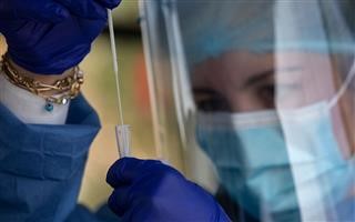  2.661 νέα κρούσματα, 11 θάνατοι, 118 διασωληνωμένοι